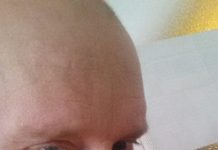 “SEGÉLYKIÁLTÁS” – Fogjunk össze Ancikáért!