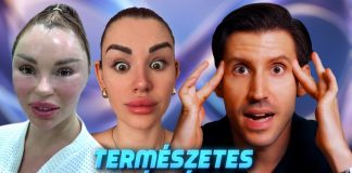 Videománia: Miért műtteti magát patikára az egész világ? 👄💉🩺