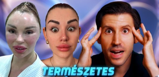 Videománia: Miért műtteti magát patikára az egész világ? 👄💉🩺